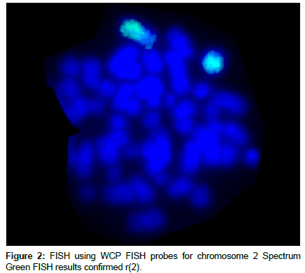 clinical-oncology-chromosome