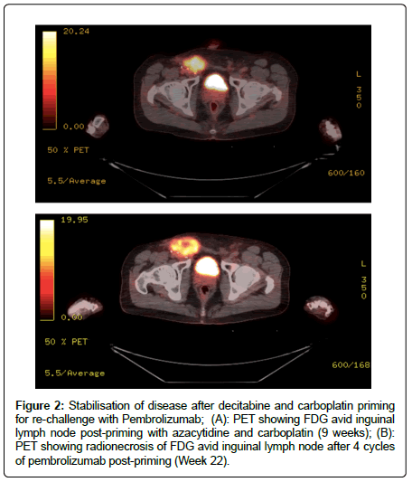 clinical-oncology-decitabine