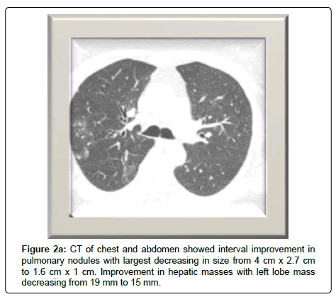 clinical-oncology-hepatic-masses