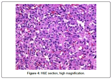 clinical-oncology-high-magnification