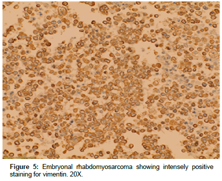 clinical-oncology-intensely-positive