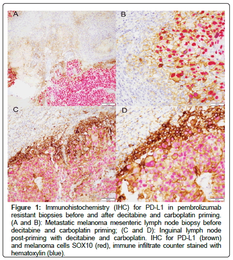 clinical-oncology-mesenteric