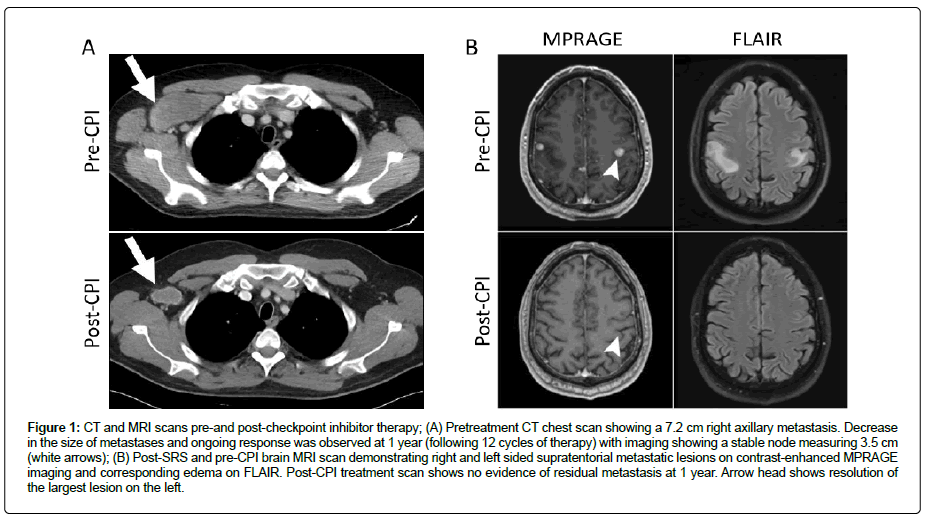 clinical-oncology-metastasis