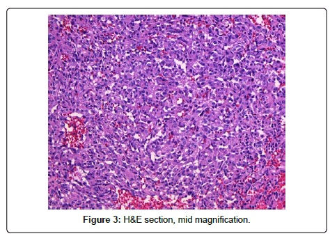 clinical-oncology-mid-magnification