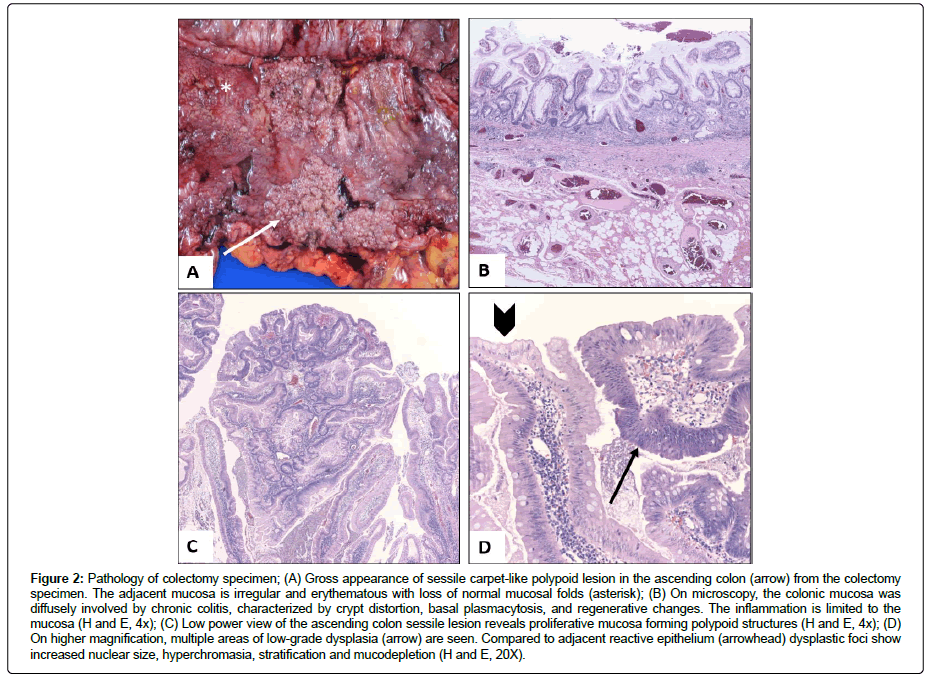 clinical-oncology-proliferative