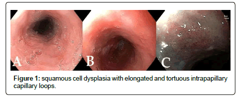 clinical-oncology-squamous-cell