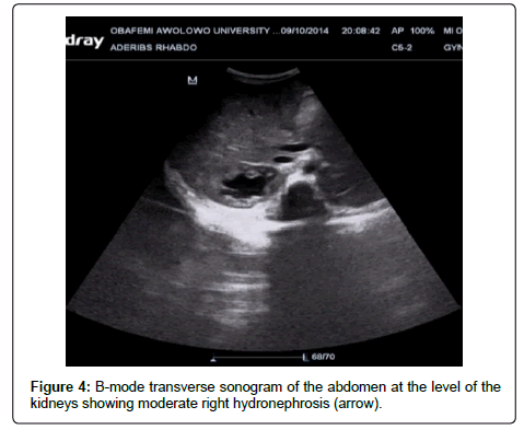 clinical-oncology-transverse-sonogram