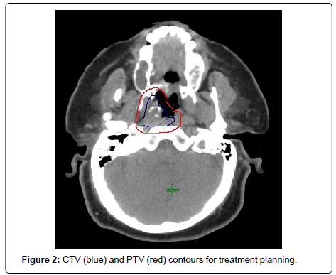 clinical-oncology-treatment-planning