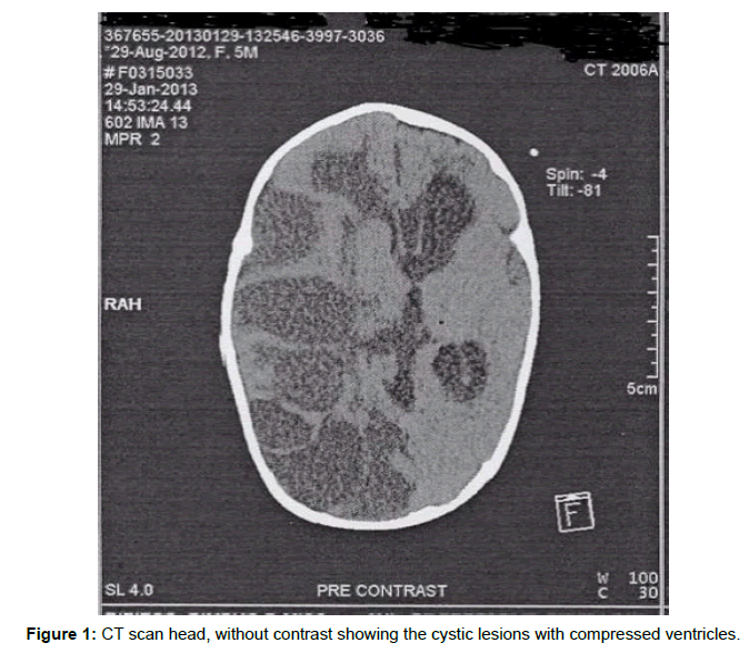 clinical-pathology-cystic-lesions