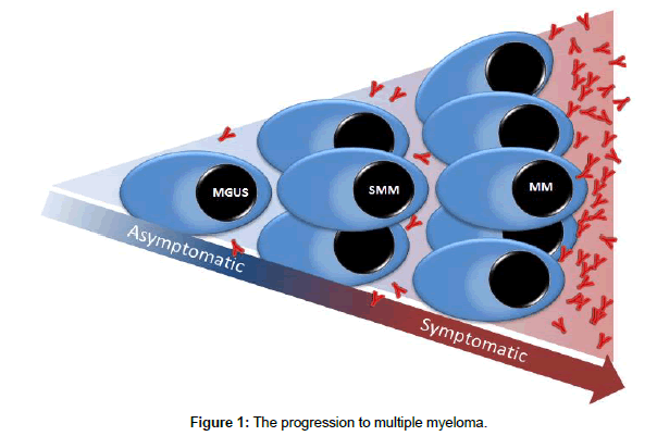 clinical-pathology-multiple-myeloma