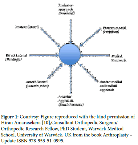 clinical-research-orthopedics-Hiran-Amarasekera