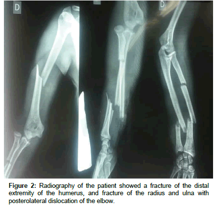 clinical-research-orthopedics-Radiography