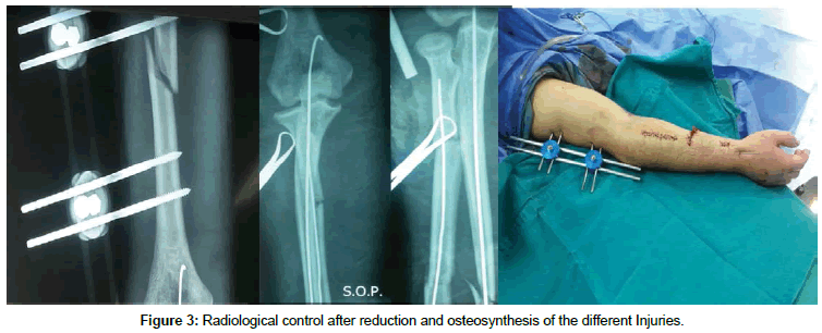 clinical-research-orthopedics-Radiological-control