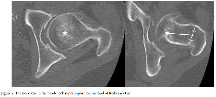 clinical-research-orthopedics-head-neck