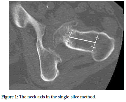 clinical-research-orthopedics-neck-axis