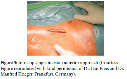 clinical-research-orthopedics-single-incision