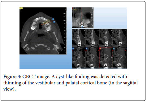 dental-health-CBCT-image