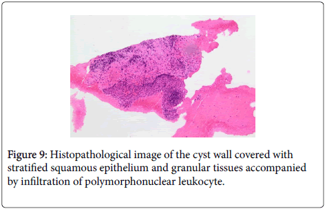 dental-health-Histopathological-image