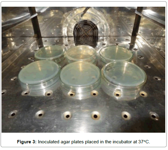 dental-health-Inoculated-agar