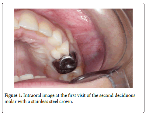 dental-health-Intraoral-image