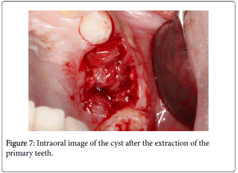 dental-health-Intraoral-image