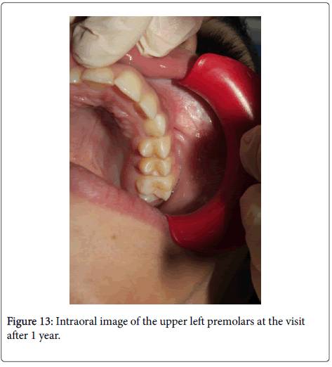 dental-health-Intraoral-image