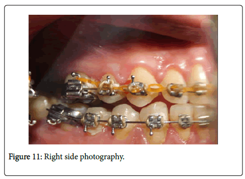 dental-health-Right-side