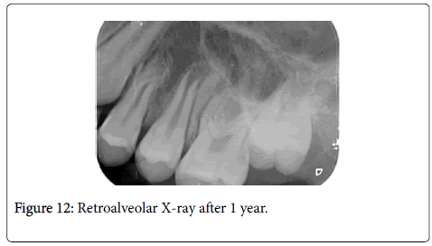 dental-health-X-ray