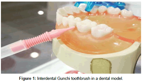 dental-health-dental-model