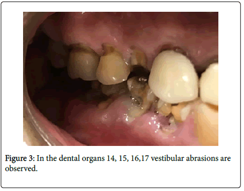 dental-health-dental-organs