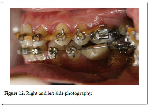 dental-health-left-side