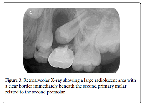 dental-health-second-primary