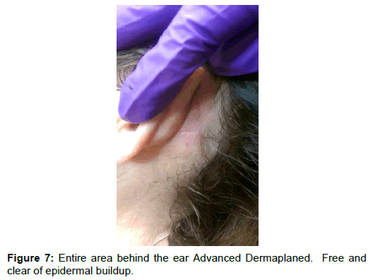 dermatology-research-ear-advanced