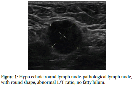 diagnostic-techniques-Hypo-echoic