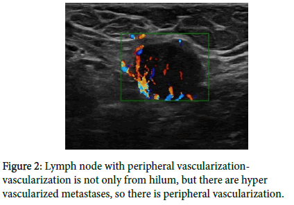 diagnostic-techniques-Lymph-node