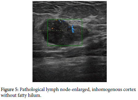 diagnostic-techniques-Pathological-lymph