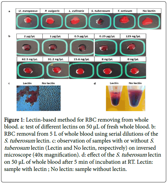 diagnostic-techniques-biomedical-analysis-Lectin