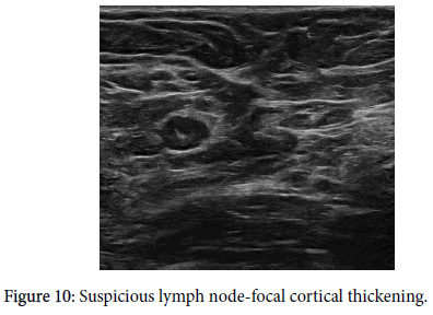 diagnostic-techniques-cortical-thickening