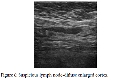 diagnostic-techniques-enlarged-cortex