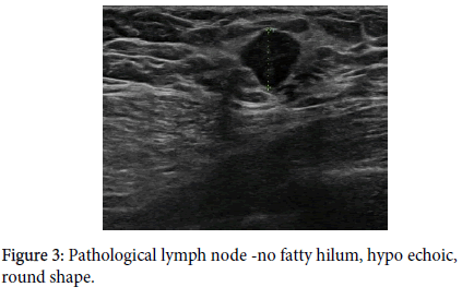 diagnostic-techniques-fatty-hilum