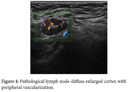 diagnostic-techniques-node-diffuse