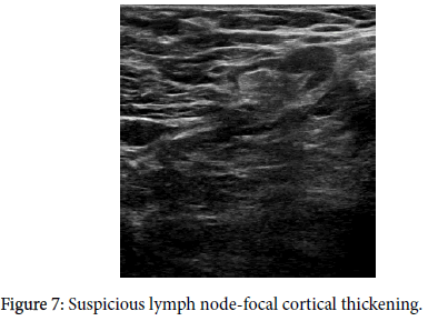 diagnostic-techniques-node-focal