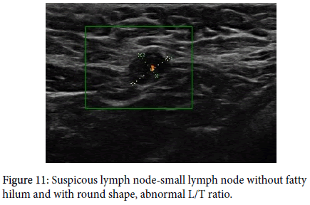 diagnostic-techniques-small-lymph