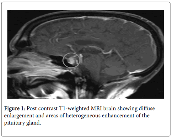 endocrinology-and-diabetes-contrast