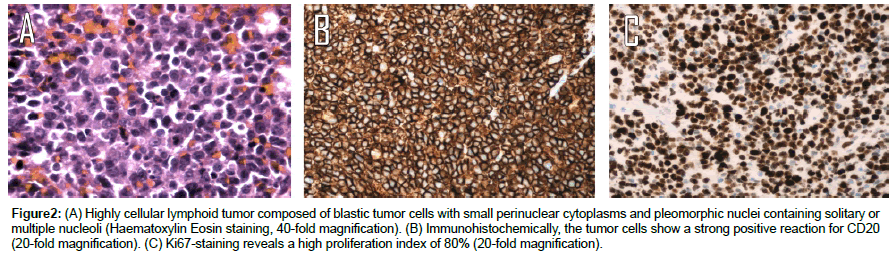 experimental-oncology-Highly-cellular