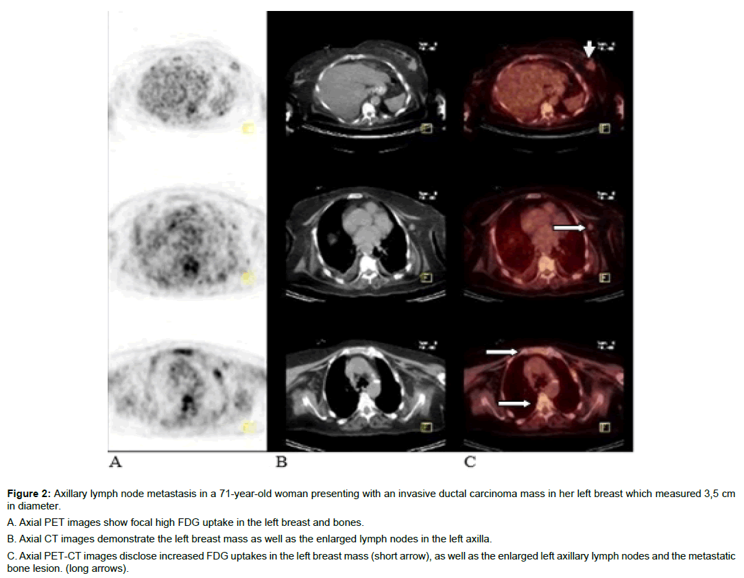 experimental-oncology-axillary-lymph-node