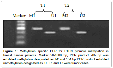 experimental-oncology-breast-cancer