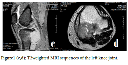 experimental-oncology-knee-joint