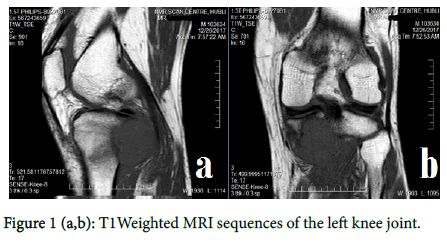 experimental-oncology-left-knee