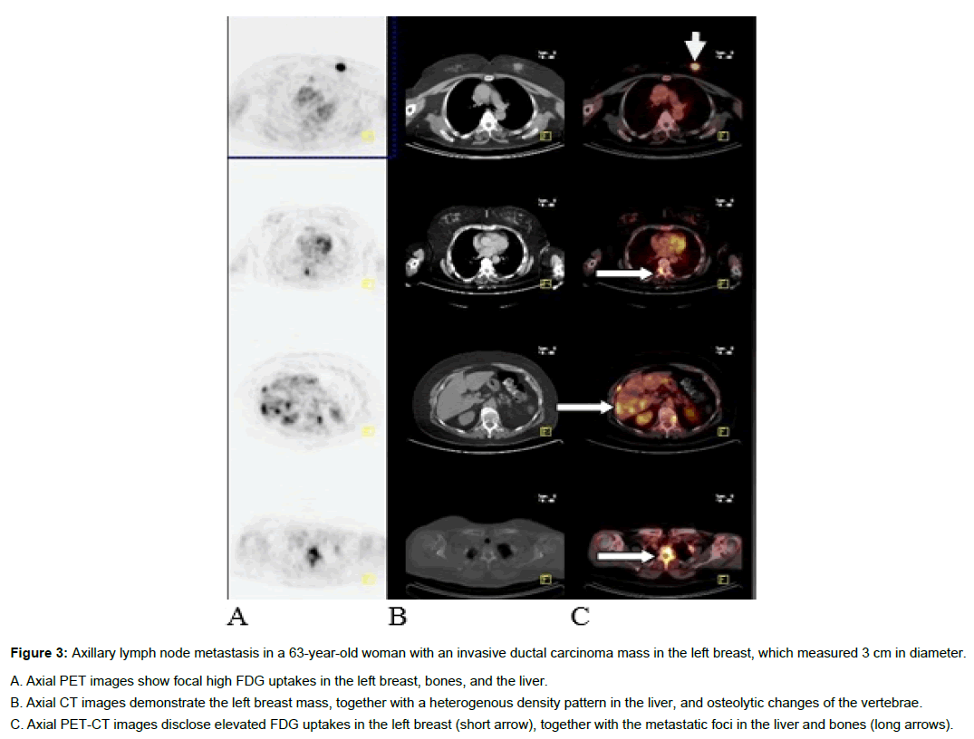 experimental-oncology-lymph-node-metastasis